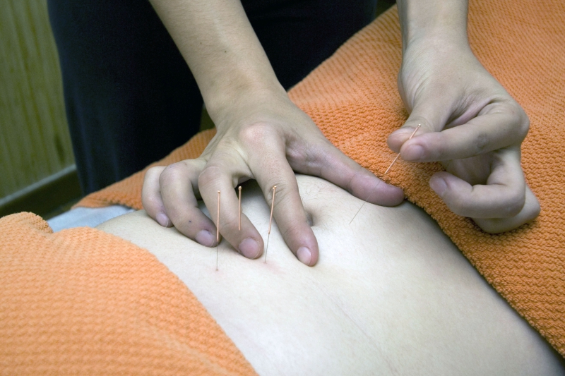 osteopathe-MEOUNES LES MONTRIEUX-min_acupuncture-4175625